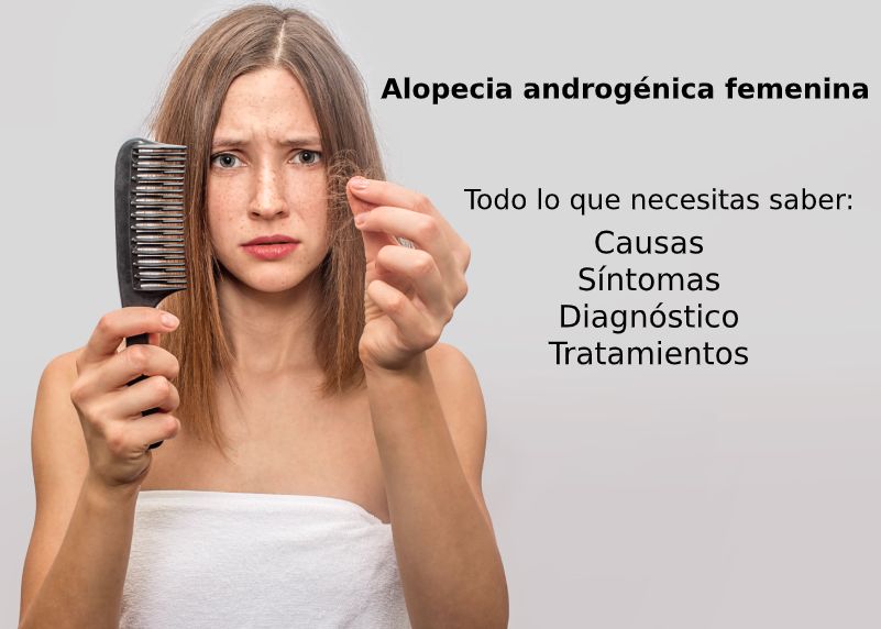 alopecia androgénica femenina